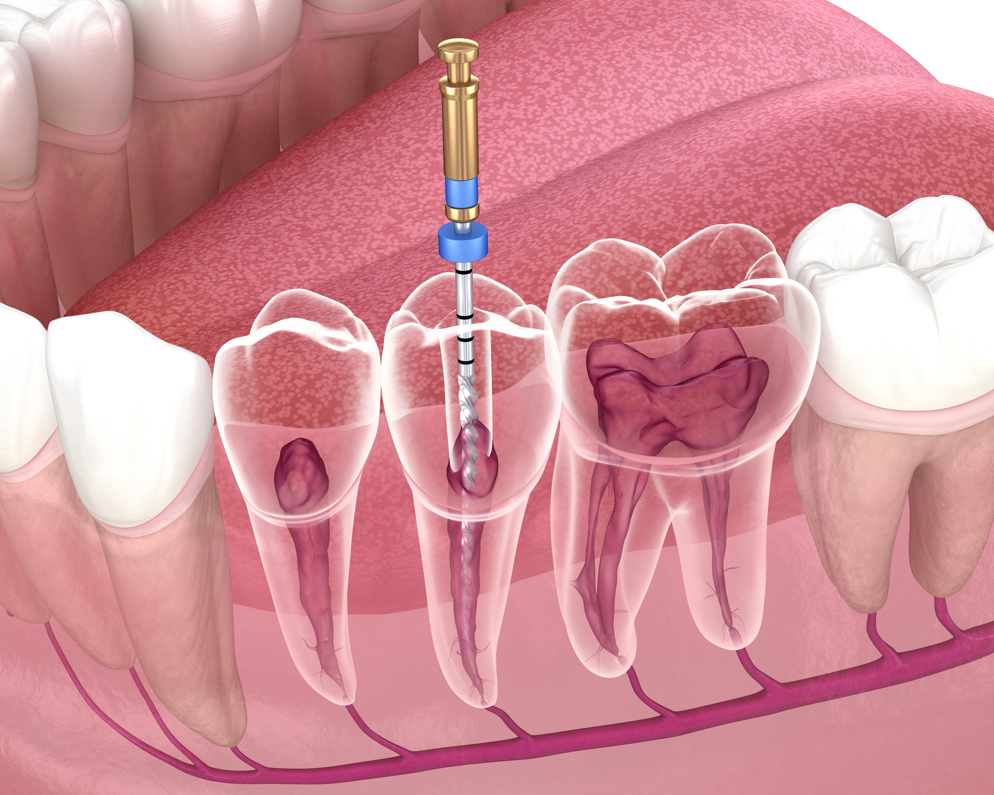 endodontiste hannut